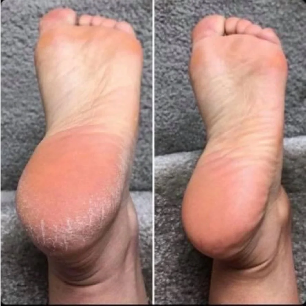 Pedicure in a bottle - Picture 7 of 9